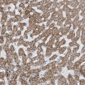 Anti-TNS2 antibody produced in rabbit Prestige Antibodies® Powered by Atlas Antibodies, affinity isolated antibody, buffered aqueous glycerol solution