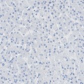 Anti-MYH11 antibody produced in rabbit Prestige Antibodies® Powered by Atlas Antibodies, affinity isolated antibody, buffered aqueous glycerol solution