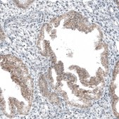 Anti-HTR1E antibody produced in rabbit Prestige Antibodies® Powered by Atlas Antibodies, affinity isolated antibody, buffered aqueous glycerol solution