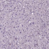 Anti-JAK3 antibody produced in rabbit Prestige Antibodies® Powered by Atlas Antibodies, affinity isolated antibody, buffered aqueous glycerol solution