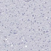 Anti-CD40LG antibody produced in rabbit Prestige Antibodies® Powered by Atlas Antibodies, affinity isolated antibody, buffered aqueous glycerol solution