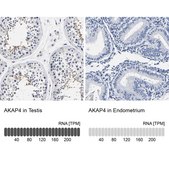 抗-AKAP4 兔抗 Prestige Antibodies® Powered by Atlas Antibodies, affinity isolated antibody, buffered aqueous glycerol solution