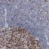 Anti-HAT1 antibody produced in rabbit Prestige Antibodies® Powered by Atlas Antibodies, affinity isolated antibody, buffered aqueous glycerol solution