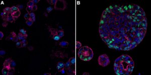 Anti-Ki67 Antibody, clone 1O15, ZooMAb® Rabbit Monoclonal recombinant, expressed in HEK 293 cells