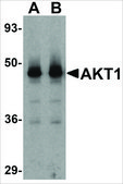 Anti-Akt1 antibody produced in rabbit affinity isolated antibody, buffered aqueous solution