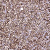 Anti-CYP11A1 antibody produced in rabbit Prestige Antibodies® Powered by Atlas Antibodies, affinity isolated antibody, buffered aqueous glycerol solution