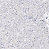 Anti-RSPH4A antibody produced in rabbit Prestige Antibodies® Powered by Atlas Antibodies, affinity isolated antibody, buffered aqueous glycerol solution
