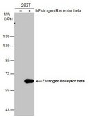 Monoclonal Anti-ESR2 antibody produced in mouse