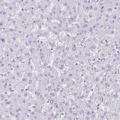 Anti-CYP11B2 antibody produced in rabbit Prestige Antibodies® Powered by Atlas Antibodies, affinity isolated antibody, buffered aqueous glycerol solution