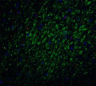 Anti-Survivin antibody produced in rabbit affinity isolated antibody, buffered aqueous solution