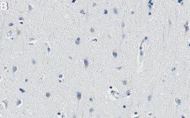 Anti-ALK Antibody, clone 1D13 ZooMAb® Rabbit Monoclonal recombinant, expressed in HEK 293 cells
