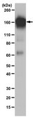 Anti-PDGFR Beta Antibody from rabbit, purified by affinity chromatography