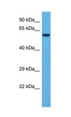Anti-TDO2, (N-terminal) antibody produced in rabbit affinity isolated antibody