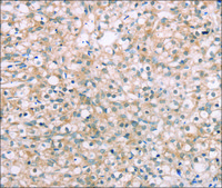 抗-ROR1 affinity isolated antibody