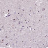 Anti-HSPA2 antibody produced in rabbit Prestige Antibodies® Powered by Atlas Antibodies, affinity isolated antibody, buffered aqueous glycerol solution