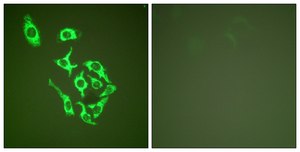 Anti-HSP60 antibody produced in rabbit affinity isolated antibody