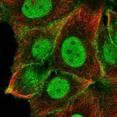 Anti-NOTCH2 antibody produced in rabbit Prestige Antibodies® Powered by Atlas Antibodies, affinity isolated antibody, buffered aqueous glycerol solution