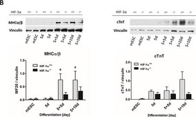 Anti-Vinculin antibody, Mouse monoclonal clone hVIN-1, purified from hybridoma cell culture
