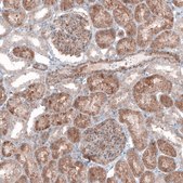 Monoclonal Anti--G6PC antibody produced in mouse Prestige Antibodies® Powered by Atlas Antibodies, clone CL5818, purified immunoglobulin, buffered aqueous glycerol solution