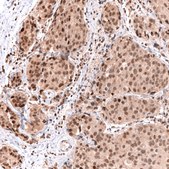 Monoclonal Anti-Msh3 Antibody Produced In Mouse Prestige Antibodies® Powered by Atlas Antibodies, clone CL14059, affinity isolated antibody, buffered aqueous glycerol solution