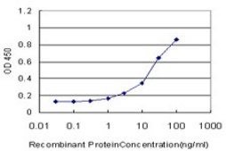 Monoclonal Anti-ASPA antibody produced in mouse clone 3C11, purified immunoglobulin, buffered aqueous solution
