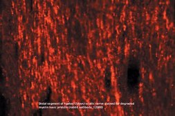 Anti-Myelin Basic Protein Antibody serum, Chemicon®