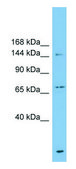 Anti-ABCB1 antibody produced in rabbit affinity isolated antibody