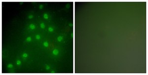 Anti-HDAC9 antibody produced in rabbit affinity isolated antibody