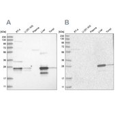 Anti-GCA antibody produced in rabbit Prestige Antibodies® Powered by Atlas Antibodies, affinity isolated antibody, buffered aqueous glycerol solution