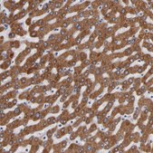 Anti-PGRMC1 antibody produced in rabbit Prestige Antibodies® Powered by Atlas Antibodies, affinity isolated antibody, buffered aqueous glycerol solution