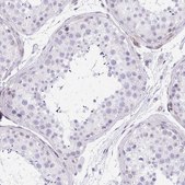 Anti-KCNN4 antibody produced in rabbit Prestige Antibodies® Powered by Atlas Antibodies, affinity isolated antibody, buffered aqueous glycerol solution