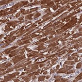 Anti-CS antibody produced in rabbit Prestige Antibodies® Powered by Atlas Antibodies, affinity isolated antibody, buffered aqueous glycerol solution