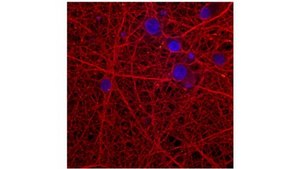 Anti-α-Synuclein Antibody, clone 2F12 clone 2F12, from mouse
