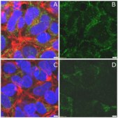 Anti-phospho-PDHE1-A type I (Ser293) Antibody from rabbit, purified by affinity chromatography