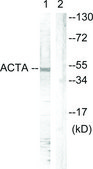 Anti-Actin-pan antibody produced in rabbit affinity isolated antibody