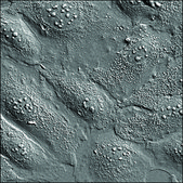 SKOV3 Cells GFP-STAT3