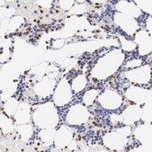 Anti-FGR antibody produced in rabbit Prestige Antibodies® Powered by Atlas Antibodies, affinity isolated antibody, buffered aqueous glycerol solution