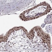 Monoclonal Anti-SNAI1 antibody produced in mouse Prestige Antibodies® Powered by Atlas Antibodies, clone CL3700, purified immunoglobulin, buffered aqueous glycerol solution
