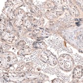 Anti-SMC6 antibody produced in rabbit Prestige Antibodies® Powered by Atlas Antibodies, affinity isolated antibody, buffered aqueous glycerol solution