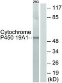 Anti-Cytochrome P450 19A1 antibody produced in rabbit affinity isolated antibody