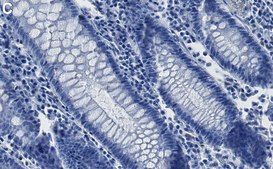 Anti-MLH1 Antibody, clone 1B15 ZooMAb® Rabbit Monoclonal recombinant, expressed in HEK 293 cells