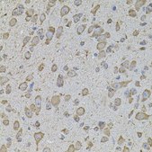 Anti-COL1A2 antibody produced in rabbit