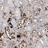 Anti-ATP11C antibody produced in rabbit Prestige Antibodies® Powered by Atlas Antibodies, affinity isolated antibody, buffered aqueous glycerol solution