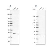 Anti-PSMB1 antibody produced in rabbit affinity isolated antibody, buffered aqueous glycerol solution, ab2