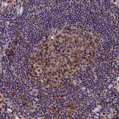 Anti-BRCA1 antibody produced in rabbit Prestige Antibodies® Powered by Atlas Antibodies, affinity isolated antibody, buffered aqueous glycerol solution