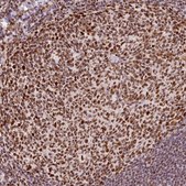 Anti-HNRNPC antibody produced in rabbit Prestige Antibodies® Powered by Atlas Antibodies, affinity isolated antibody, buffered aqueous glycerol solution