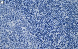 Anti-RRM1 Antibody, clone 1E20 ZooMAb® Rabbit Monoclonal recombinant, expressed in HEK 293 cells
