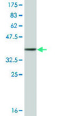 Monoclonal Anti-TNNT3, (C-terminal) antibody produced in mouse clone 1H4, ascites fluid