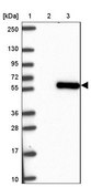 Anti-SMAD5 antibody produced in rabbit Prestige Antibodies® Powered by Atlas Antibodies, affinity isolated antibody, buffered aqueous glycerol solution