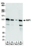 Rabbit anti-KAP-1 Antibody, Affinity Purified Powered by Bethyl Laboratories, Inc.